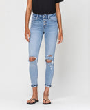 Sunney - High Rise Button Up Ankle Cuff Skinny Jeans